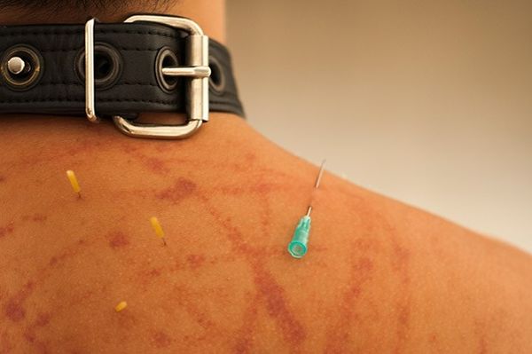 The Finer Points of Needle Play