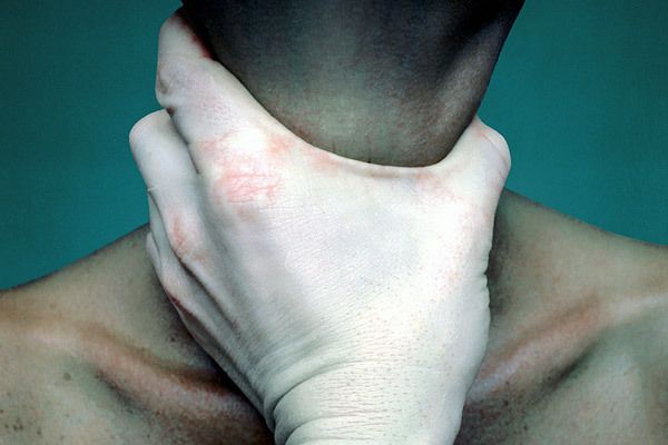 Drugs and Asphyxiation