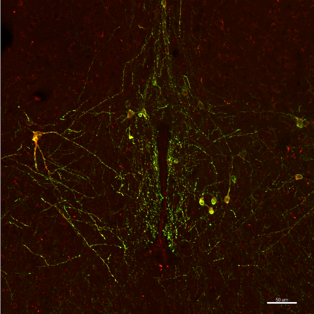 The Neuroscience of Sub Space in BDSM - Endorphins, Noradrenaline and Serotonin