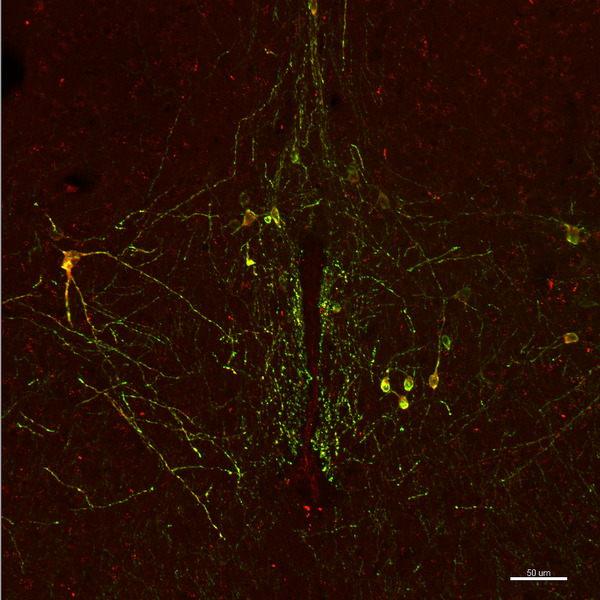 The Neuroscience of Sub Space in BDSM - Endorphins, Noradrenaline and Serotonin