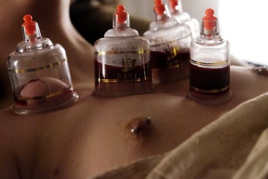 Ms160 Watches a Blood Cupping Scene