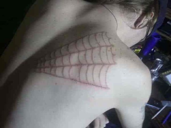 Using Your Violet Wand Branding Electrode