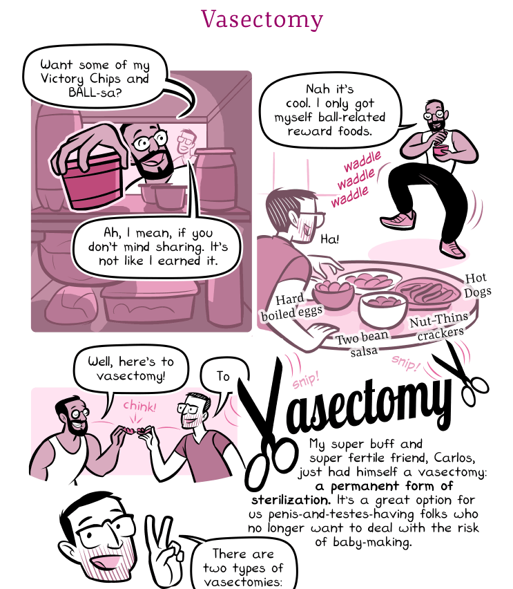 Vasectomy