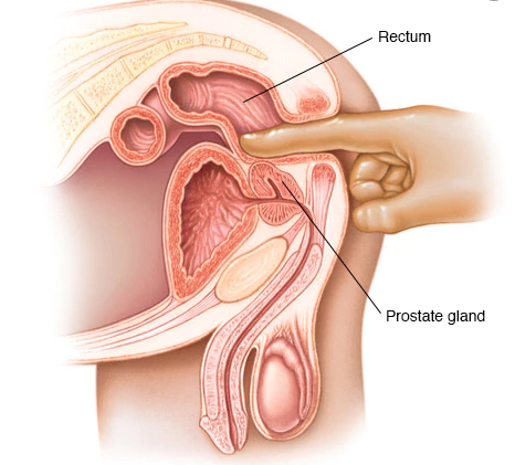 Male G Spot - Find His G-Spot
