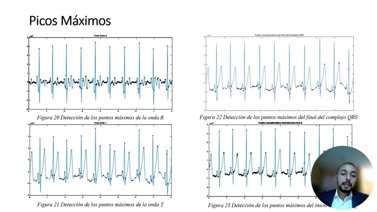 CDX279 - Procesamiento de Señales Aplicado a la Detección de Características de Señales Electr…