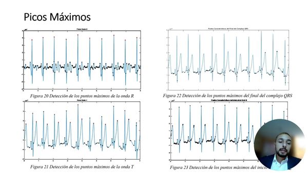 CDX279 - Procesamiento de Señales Aplicado a la Detección de Características de Señales Electr…