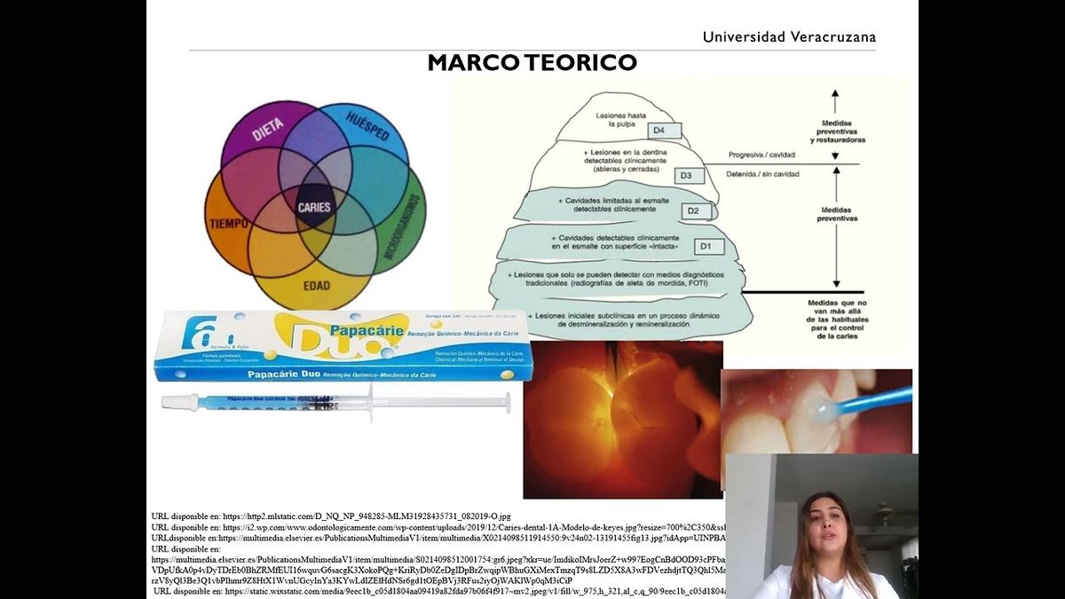 ITP021 - Nuevas Alternativas para el Manejo de la Caries Dental