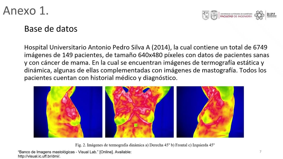 CPS007 - Redes Neuronales Convolucionales para Clasificación de Imágenes Termográficas Infrarroj…