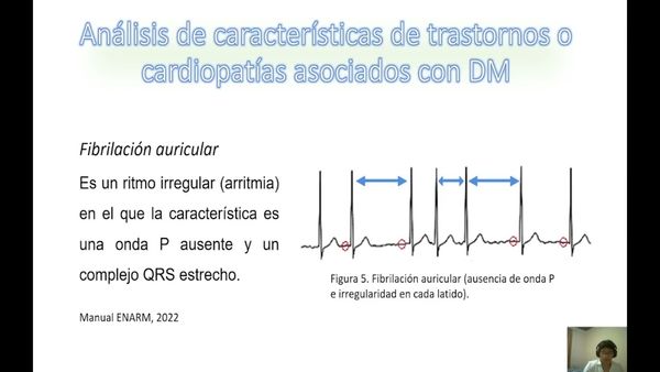 CIP081- Procesamiento Aplicado al Análisis de Características de Señales ECG Relacionado con Dia…