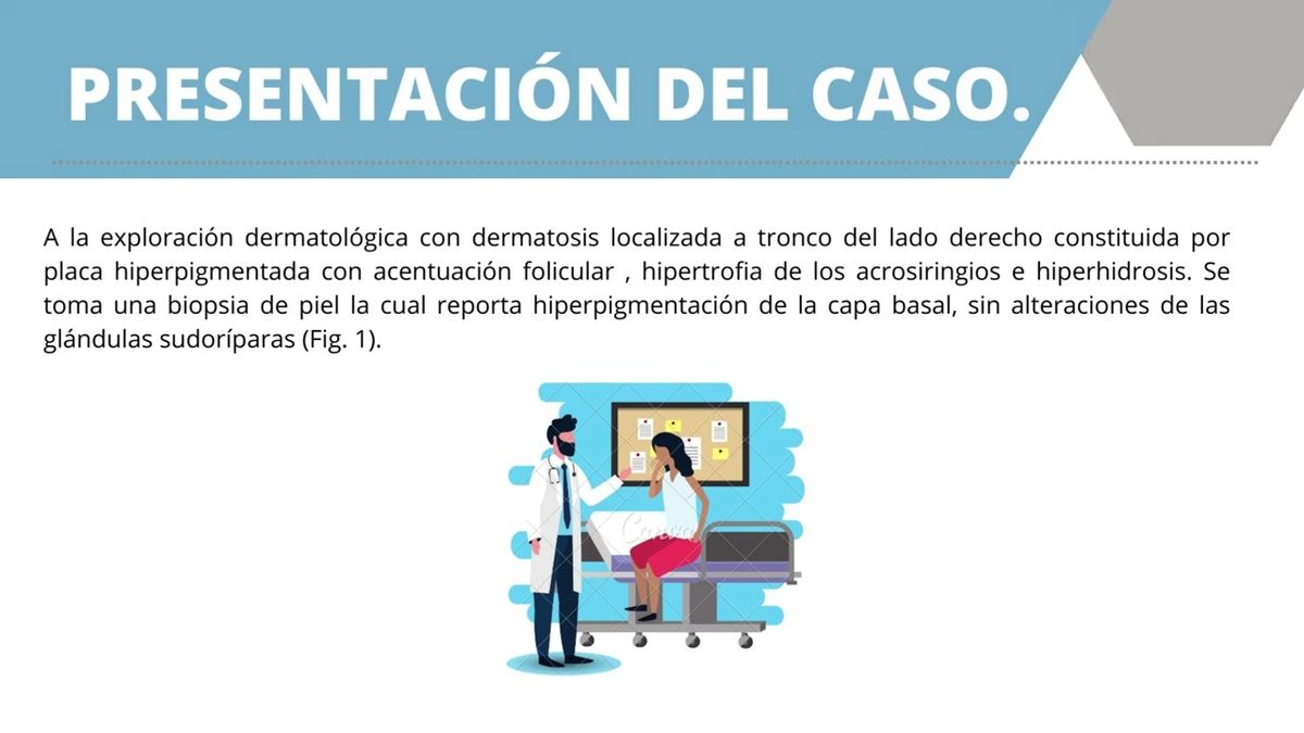 ITP241 - Hiperhidrosis Localizada Unilateral idiopática: Reporte de Caso