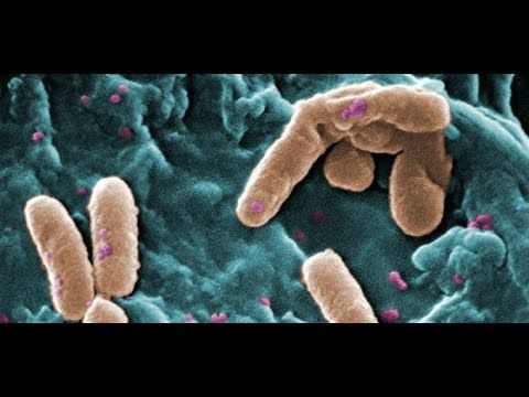 HHH114 - Efecto Antibacterial In Vitro del Compósito de Hidroxiapatita-Ag / Hidroxiapatita-Cu sob…