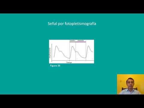 H306 - DISEÑO Y CONSTRUCCIÓN DE UN MONITOR DE PULSOS CARDÍACOS