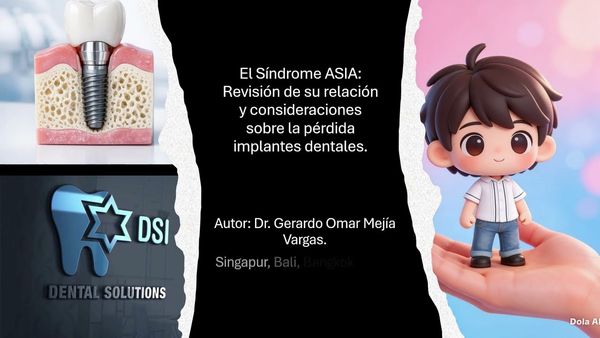 ItG004- Revisión de su relación y consideraciones sobre la pérdida implantes dentales. # Integra…