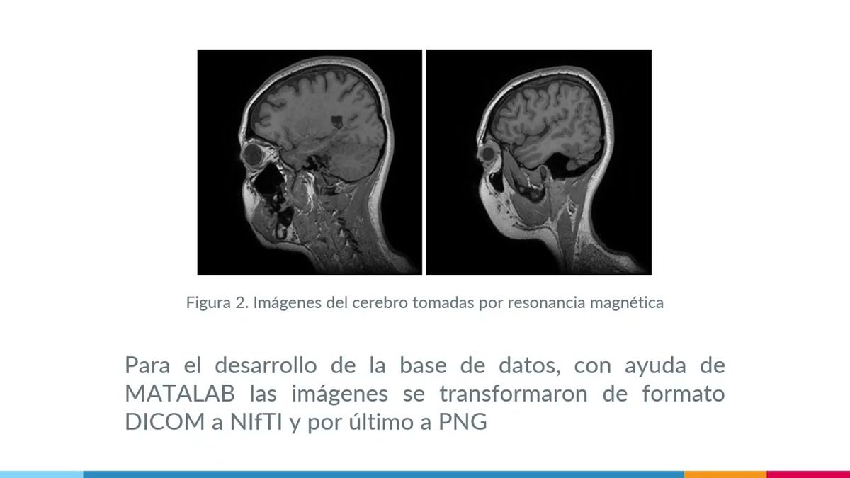 CDX384 - Dual Channel UNet para la Segmentación Automática de Materia Blanca del Cerebro en Imá…