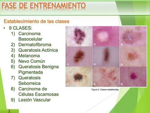 CLY200 - Sistema para la Detección de Lesiones Dermatológicas Basado en el Descriptor RTS y un Cl…