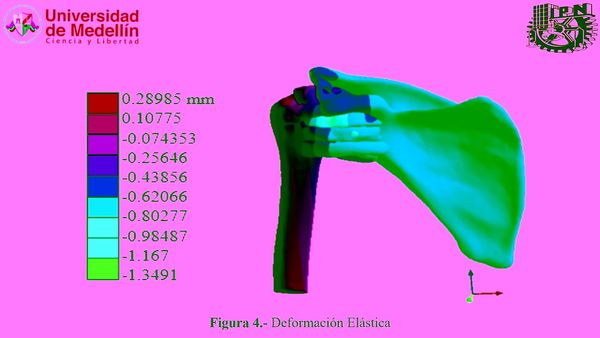 MED050 - Desarrollo de un Biomodelo Tridimencional de la Articulación Glenohumeral a partir de Im