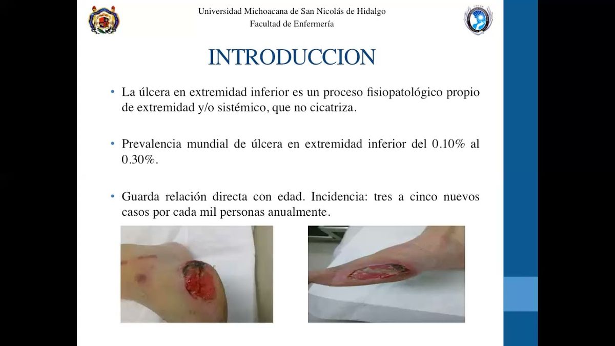 MOR283 - Características Sociodemográficas de Adultos con Úlcera en Extremidad Inferior