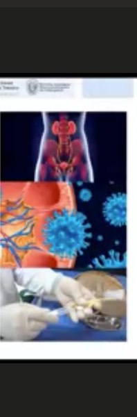 AJA102 - Protocolo Estandarizado para el Cuidado de Pacientes con Sonda Vesical: Resultados y Desaf…