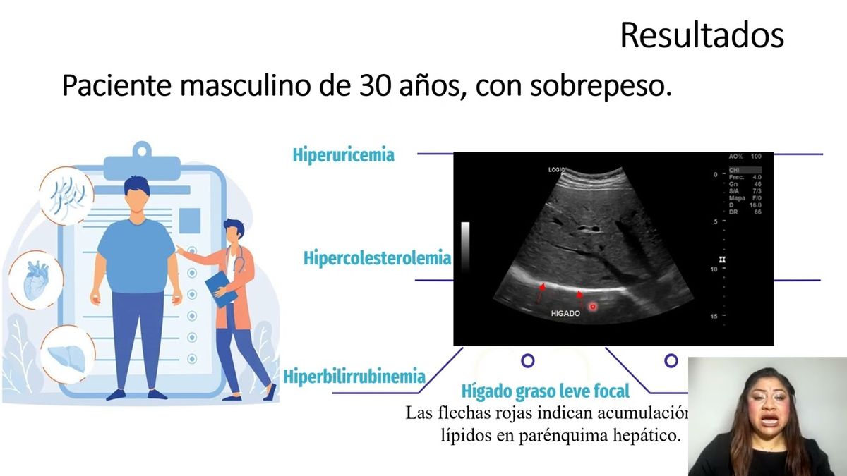 CEL375 - Caso Clínico:Efectos Benéficos de la Astaxantina y Fucoxantina en Paciente con Estrés, …