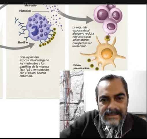 HDG209 - Incidencia de Alergias en Nicolas Romero Estado de México