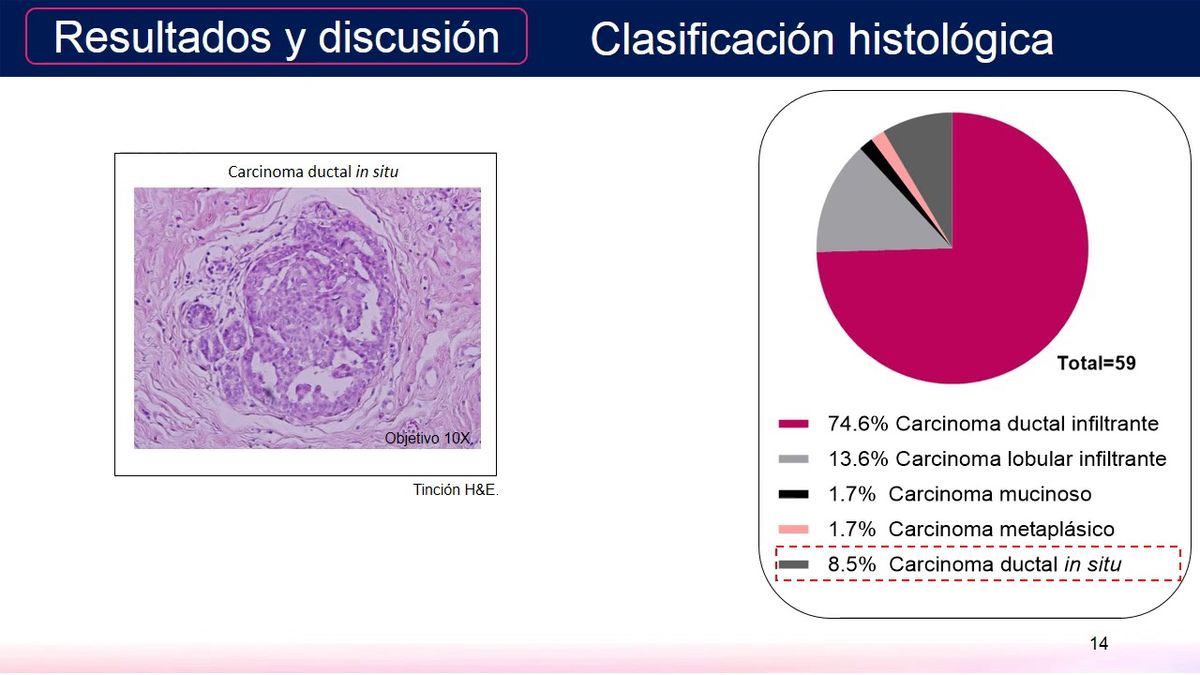 T101 - DETECCIÓN DE ADN DEL VIRUS DEL PAPILOMA HUMANO EN CARCINOMAS MAMARIOS DE MUJERES MEXICANAS