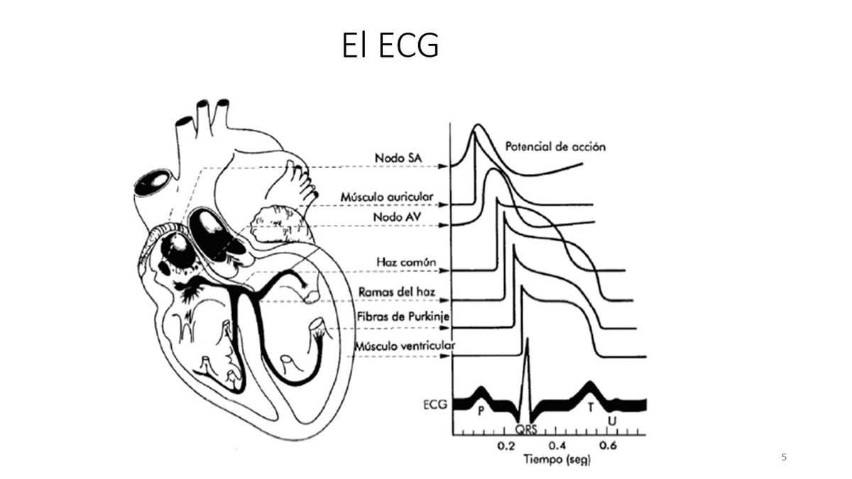 A054 - Análisis Numérico de un Electrodo Seco para Electrocardiograma