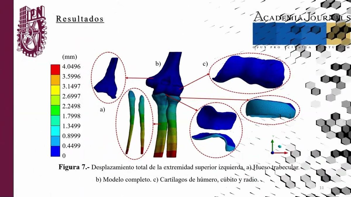 CTM097 - Análisis numérico del modelo 3D de la extremidad superior izquierda bajo carga a tensió…