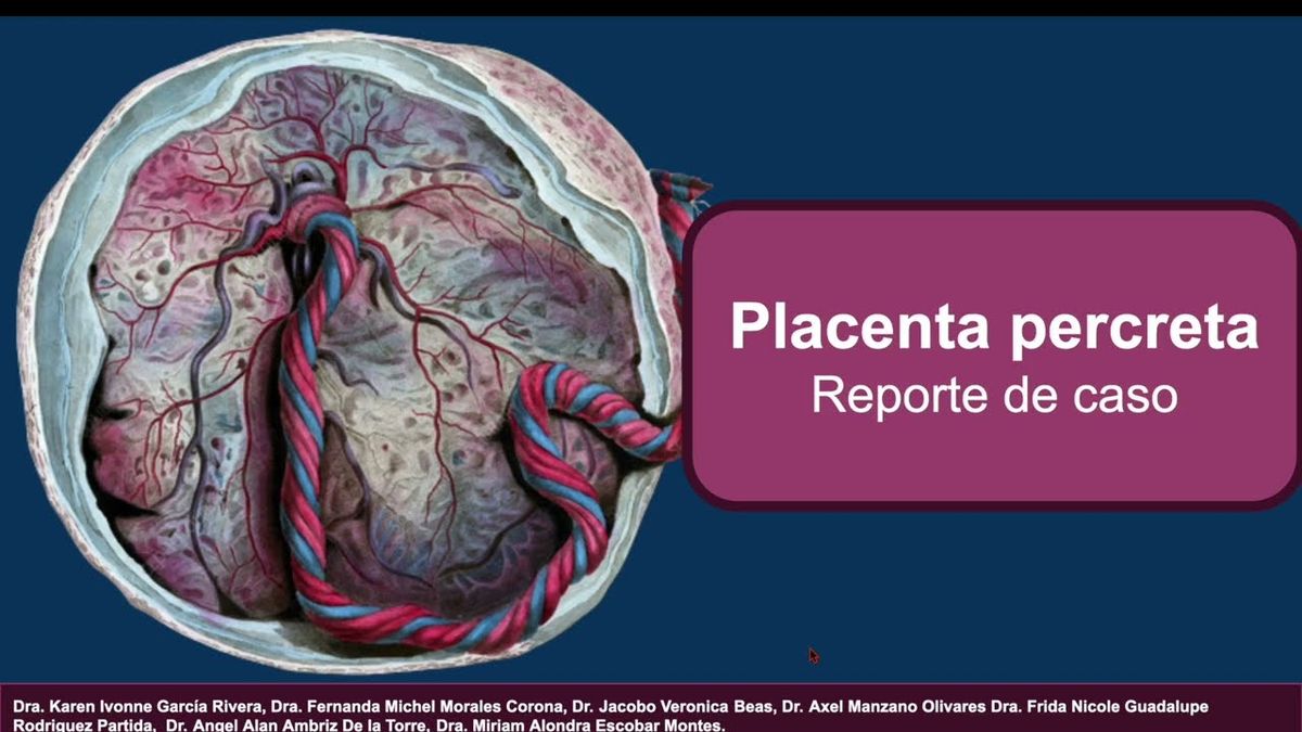 HLG318 - Placenta Previa: A Propósito de un Caso