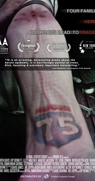 75 (2017)