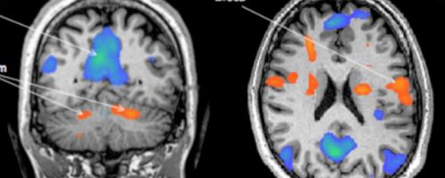 New sniff device allows paralyzed to move and write | ISRAEL21c